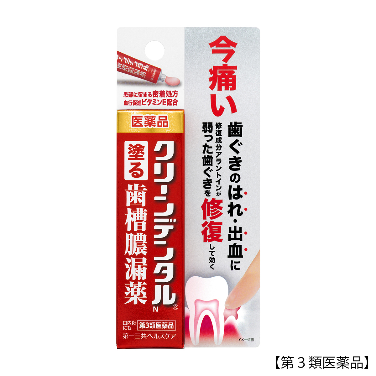 クリーンデンタルＮ歯槽膿漏薬　８Ｇ