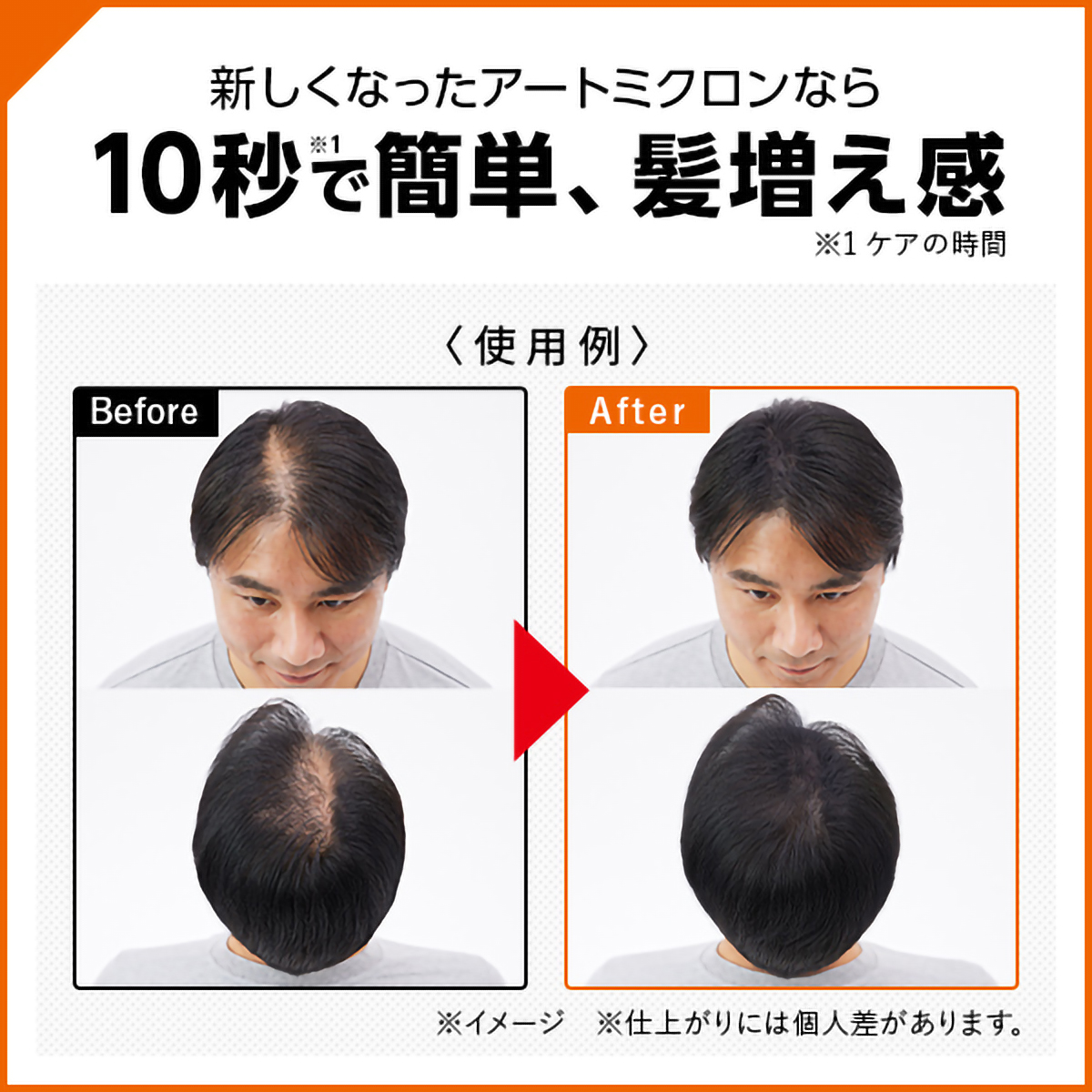 アートミクロン　パウダー＆スプレーセット　（男性用）