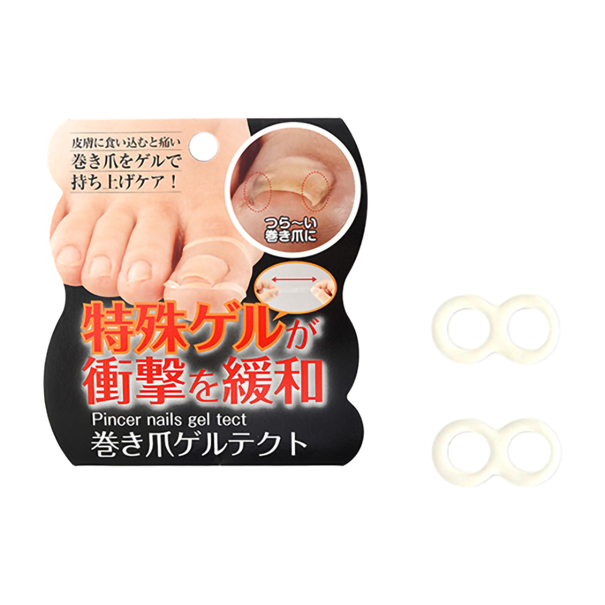 巻き爪ゲルテクト