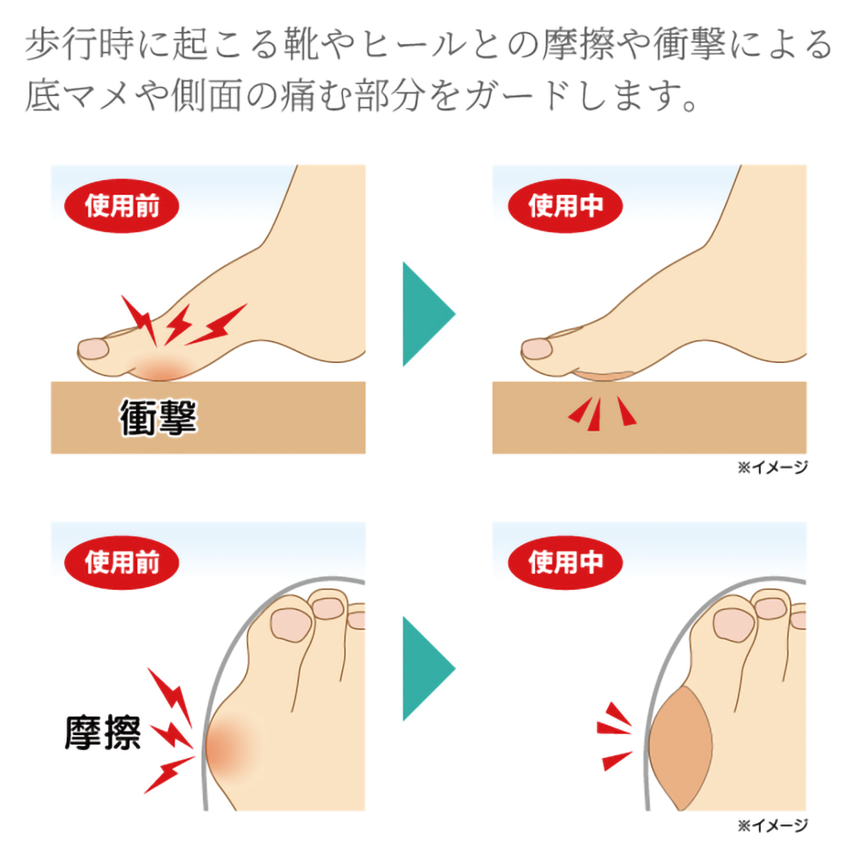 「まめまもーる」 クッションケアテープ