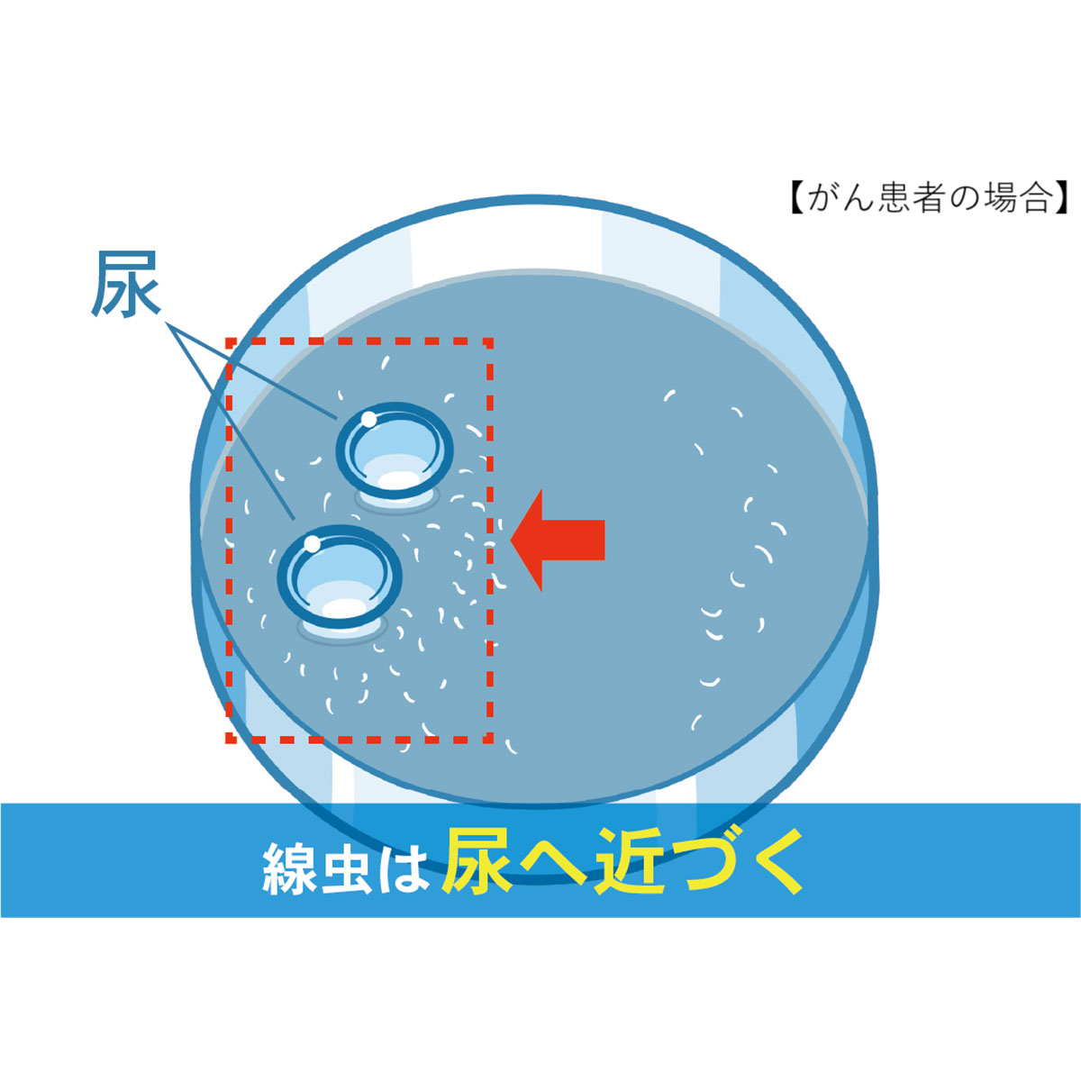 【直送】がんリスク検査　N-NOSE