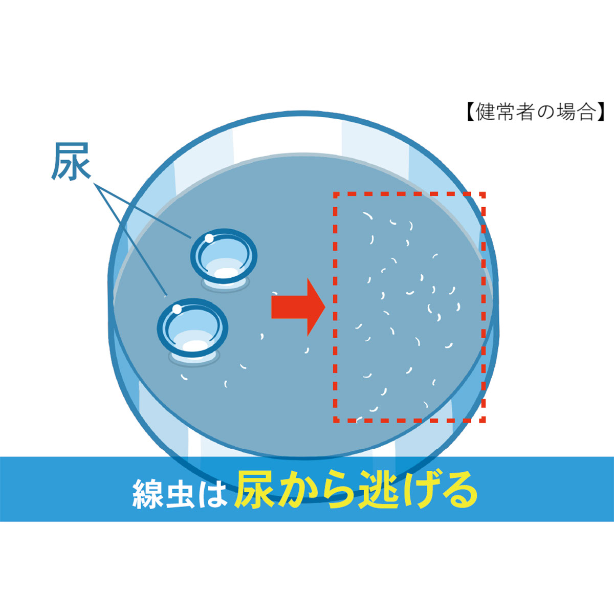 【直送】がんリスク検査　N-NOSE