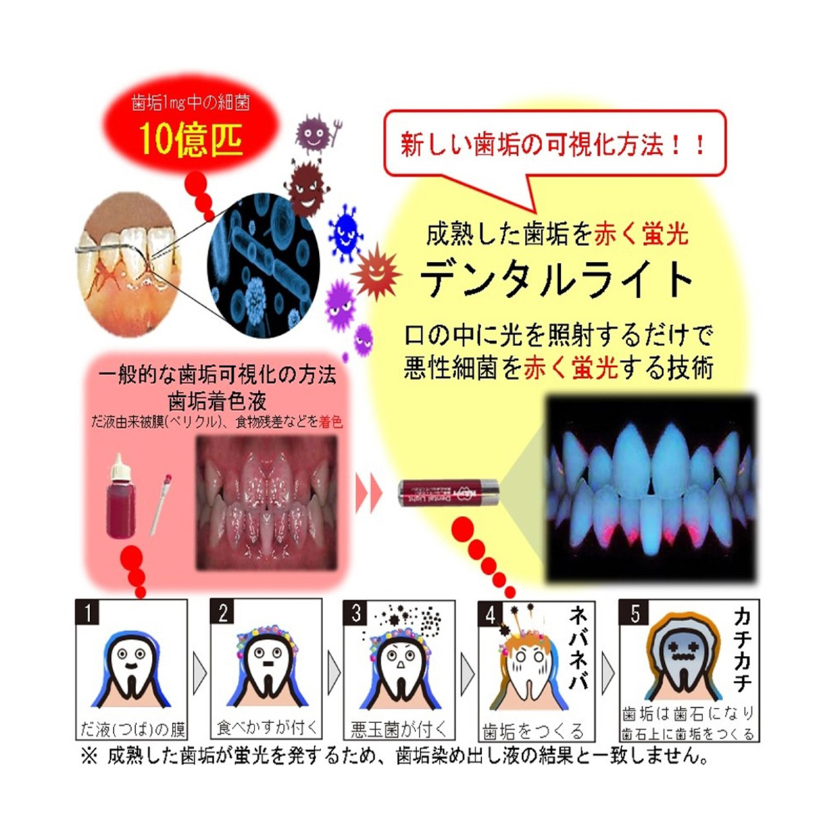デンタルライト