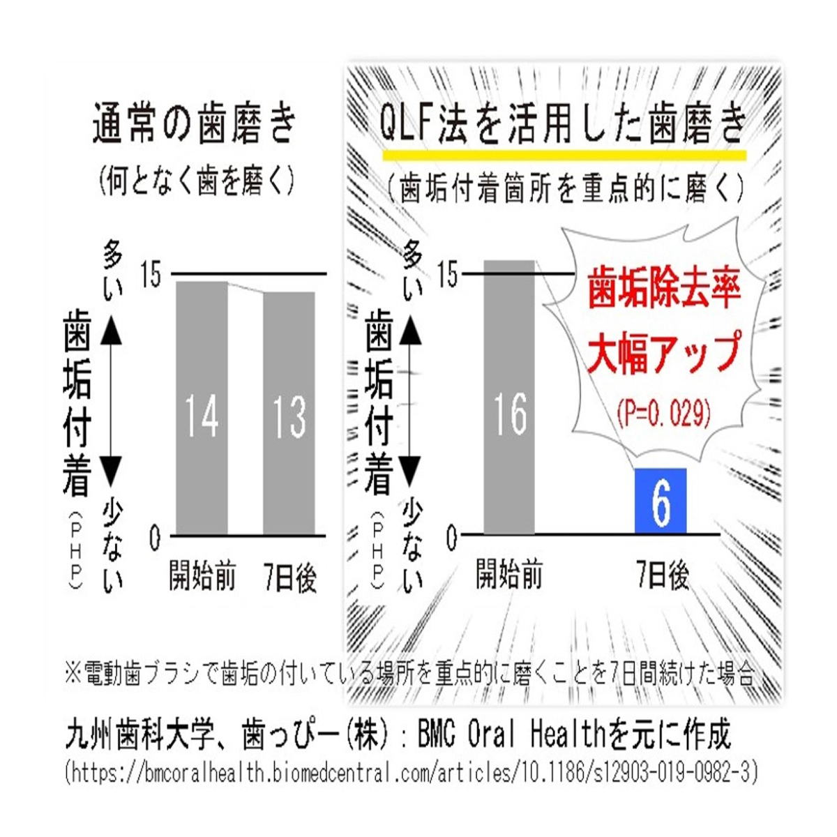 デンタルライト