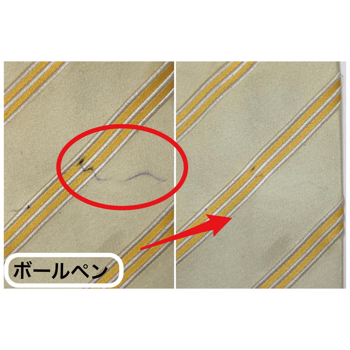 スポッとるクリア　30ml
