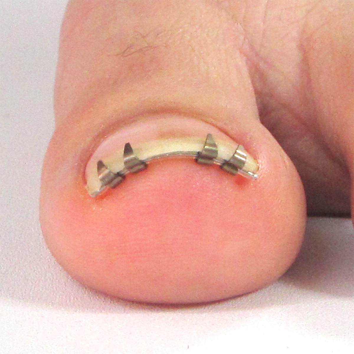 まきづめリフト