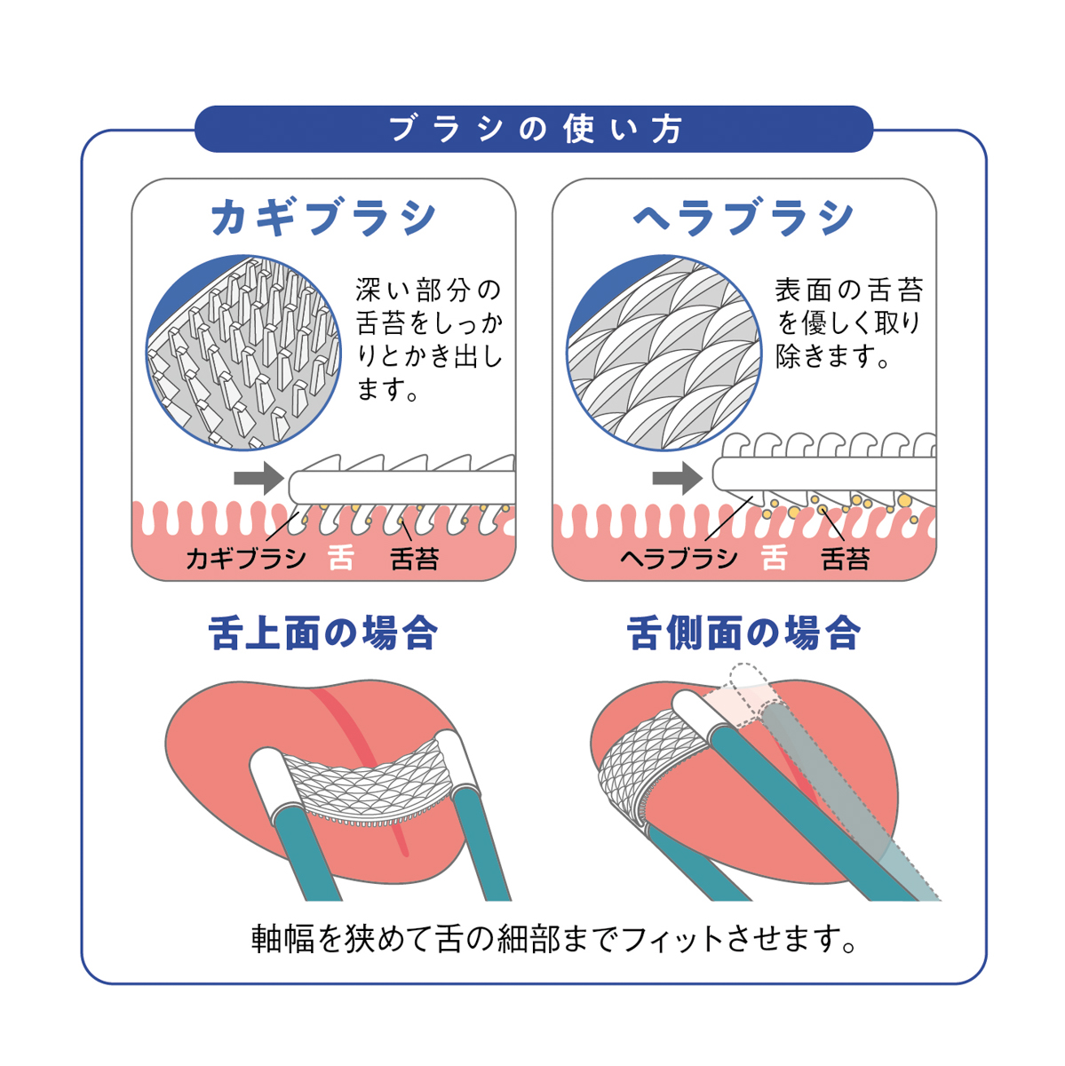 松本金型　新感覚舌ブラシ したつつみNEO
