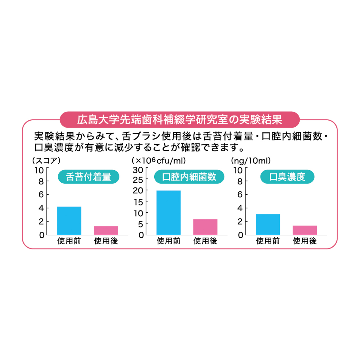 松本金型　新感覚舌ブラシ したつつみNEO