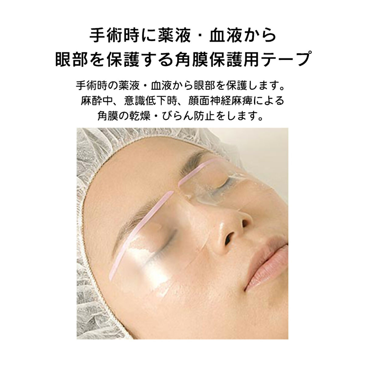 メパッチクリアSG(M) 角膜保護用テープ ニチバン MPCSGM(33×55)2×50
