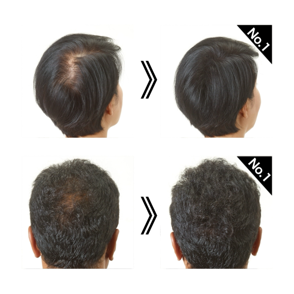 スーパーミリオンヘアーEX 20ｇ