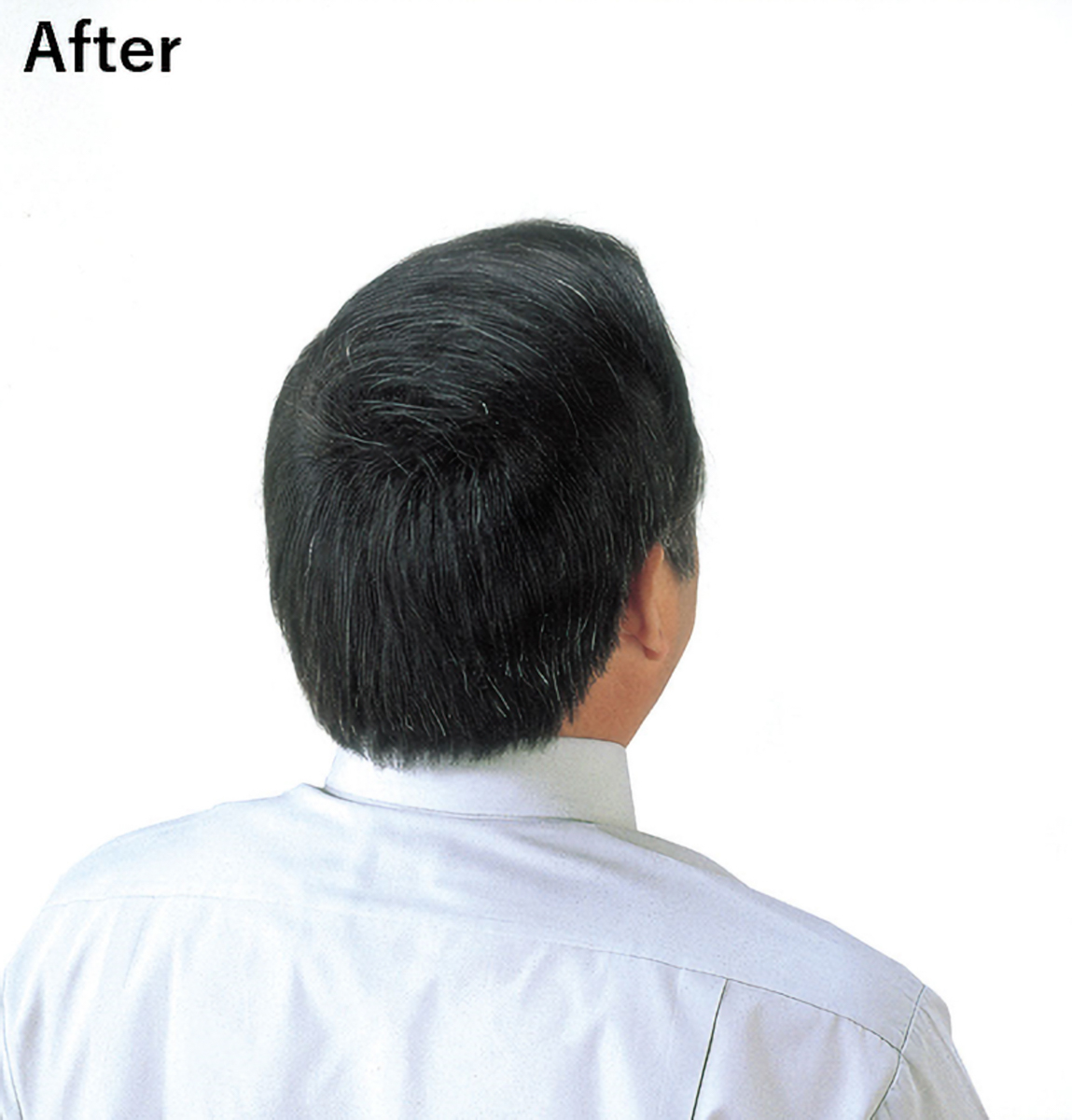 スーパーミリオンヘアーEX 20ｇ