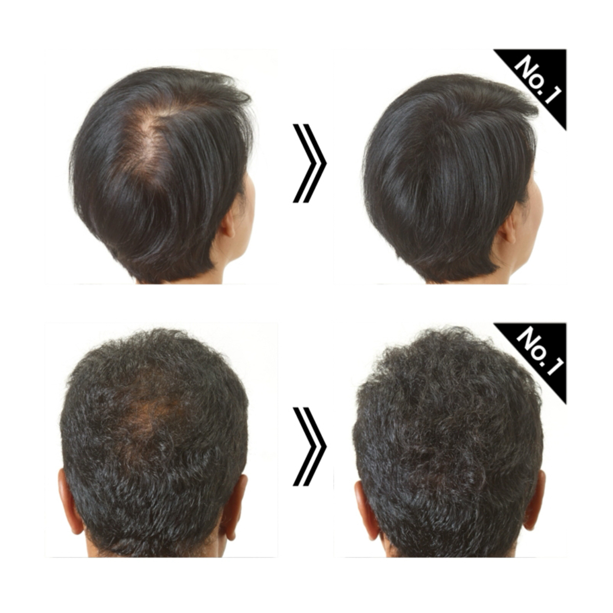 スーパーミリオンヘアーEX トラベルセット